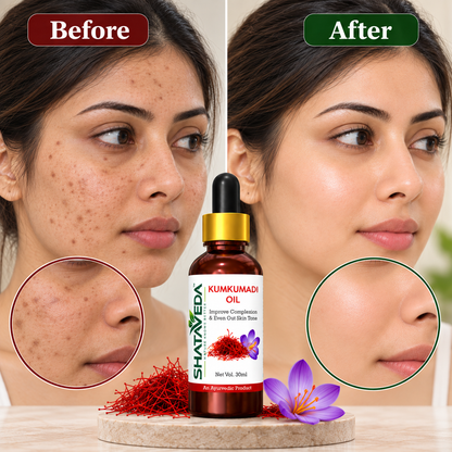 Kumkumadi Oil 30 ml | Skin Appearance & Even Tone